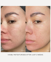 Westman Atelier - Skin Activator Serum Rollerball Duo