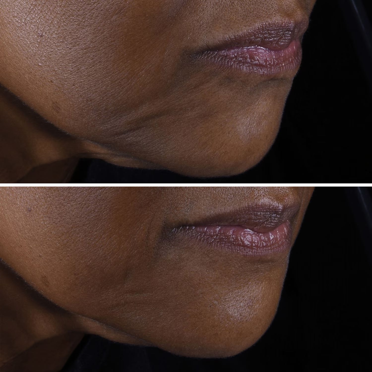 CLINIQUE - Smart Clinical Repair Lifting Face + Neck Cream - Micro-Lift Moisturizer