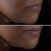 CLINIQUE - Smart Clinical Repair Lifting Face + Neck Cream - Micro-Lift Moisturizer