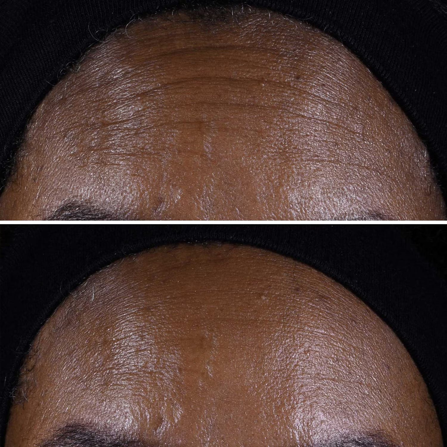 CLINIQUE - Smart Clinical Repair Lifting Face + Neck Cream - Micro-Lift Moisturizer