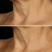 CLINIQUE - Smart Clinical Repair Lifting Face + Neck Cream - Micro-Lift Moisturizer